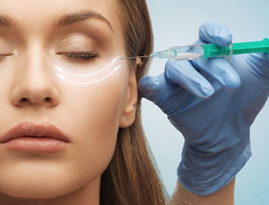 Hyaluronsäure Filler