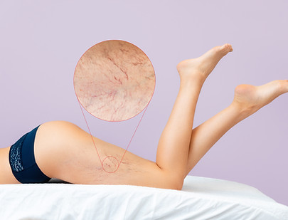 iStock-1356623305.jpg
