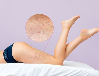 iStock-1356623305.jpg
